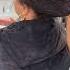 Scalp Inflammation Here S Some Solutions For Relief Scalp