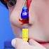 Lego Stuck In Nose For 26 Years