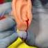 First Aid On An Injured Eardrum Ambulance Paramedic Emergency Firstaid Hospital Nurse