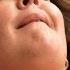 Up To 180 Orgasms In Two Hours Woman Living With Persistent Genital Arousal Disorder