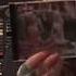 My Cannibal Corpse Collection Part 1 The Barnes Era