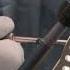 Blount S Disease Part 3 Clinical Case Video Demonstration A Cherkashin