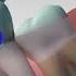 Wisdom Teeth See Why And How They Re Removed Wisdomteeth Teeth Oralhealth