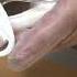 Parts Of A Tracheostomy Tube