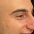 Rhinoplasty Turkey Dr Ahmet Dilber Plasticsurgery Rhinoplastyturkey Rhinoplasty Nose