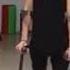 Beautiful Paralised Girl Walking With AFO S And Crutches