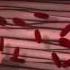 Acute Inflammation Educational 3D Animation