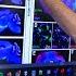 How New Biological Tools Are Changing The Game In The Battle Against Brain Disease