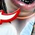 BLACK TEETH Prank On GIRLFRIEND HILARIOUS