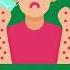 Penicillin Allergy Signs And Symptoms Shorts