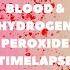 Hydrogen Peroxide Vs Blood Stains Laundry