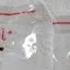 Chinese Nationals Charged With Smuggling Devastating Biological Pathogen Into US