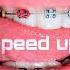GAVRILINA Брекеты Speed Up