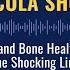 Iron And Bone Health The Shocking Link