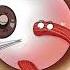 Crossed Eyes FIXED With Surgery Strabismus Hypertropia Explained
