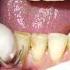 Smoker S Teeth Dental Cleaning Shorts