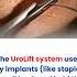 UroLift Procedure Fix For Enlarged Prostate Urology Dr Shashikant Asabe