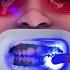 Amazing Teeth Whitening