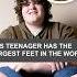 This Teenager Has The Largest Feet In The World