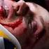 Teenager Falls Off An Overpass Onto A Car Chicago Med