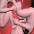 AMAZING TWINS FIGHTING INSIDE THE WOMB FOR SUPREMACY 3D ANIMATION