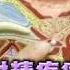 射精疼痛排尿卡卡 細菌入侵GG了 台灣蘋果日報