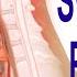 Swallowing Problems Or Dysphagia Top 4 Possible Causes Including Cricopharyngeal Dysfunction CPD