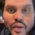 The Weeknd S Plastic Surgery Before And After MUST WATCH Tiktok Edition Read Description