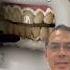 Professional Teeth Whitening Vs Hydrogen Peroxide EXPLAINED In Office To Hands On Dental Training