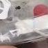 Portex Brovana Tracheostomy