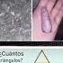 Quienquiera Que Haya Pintado Esta Roca Para Que Parezca Un Dedo