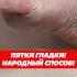 Пятки гладки Народный способ пятки педикюр уходзакожей трещинынапятках грубаякожа кожа