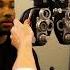 Dr Dinga Explains What Presbyopia Really Is And What You Can Do About It