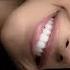 PAID REQ FIX TEETH For Shape Stains Cavities Plaque SPARKLING WHITE STRONG TEETH