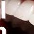 Ideal Dental Health Regenerate Remineralize Heal Teeth Gums Classical Music