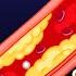 Your Doctor Is Wrong About Cholesterol