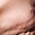 The Perfect Shoulder Exercise DON T SKIP THIS