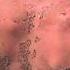 Do THIS If You Get A Sunburn Viral