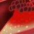 Cholesterol Animation Heart Disease Risk Factors