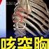 男染新冠劇咳突胸前 啪一聲 就醫驚見 斷5肋骨