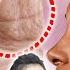 Knocking Here Like This Secretes Rejuvenating Hormones To Remove Wrinkles Around Eyes