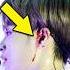 Kpop Idols Bleeding On Stage Kpop