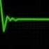 Type O Negative Anesthesia