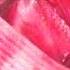 Laparoscopic Pectopexy