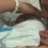Live Birth Epidural