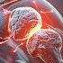 Stanford Rheumatologist Reveals Surprising Causes Of Joint Pain