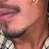 Day 15 Of Using Man Matters Minoxidil 5 For Beard Growth Beardgrowth Minoxidilresult Viral