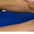 Pivot Shift Test Anterior Cruciate Ligament ACL Rupture Knee