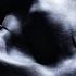 Hayit Murat Akmalov Where Is She Original Mix 432Hz