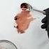 Blood Stain Removal Guide Stain Laundry Bloodstain